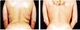 before and after lower back