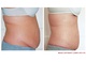 female stomach inch loss